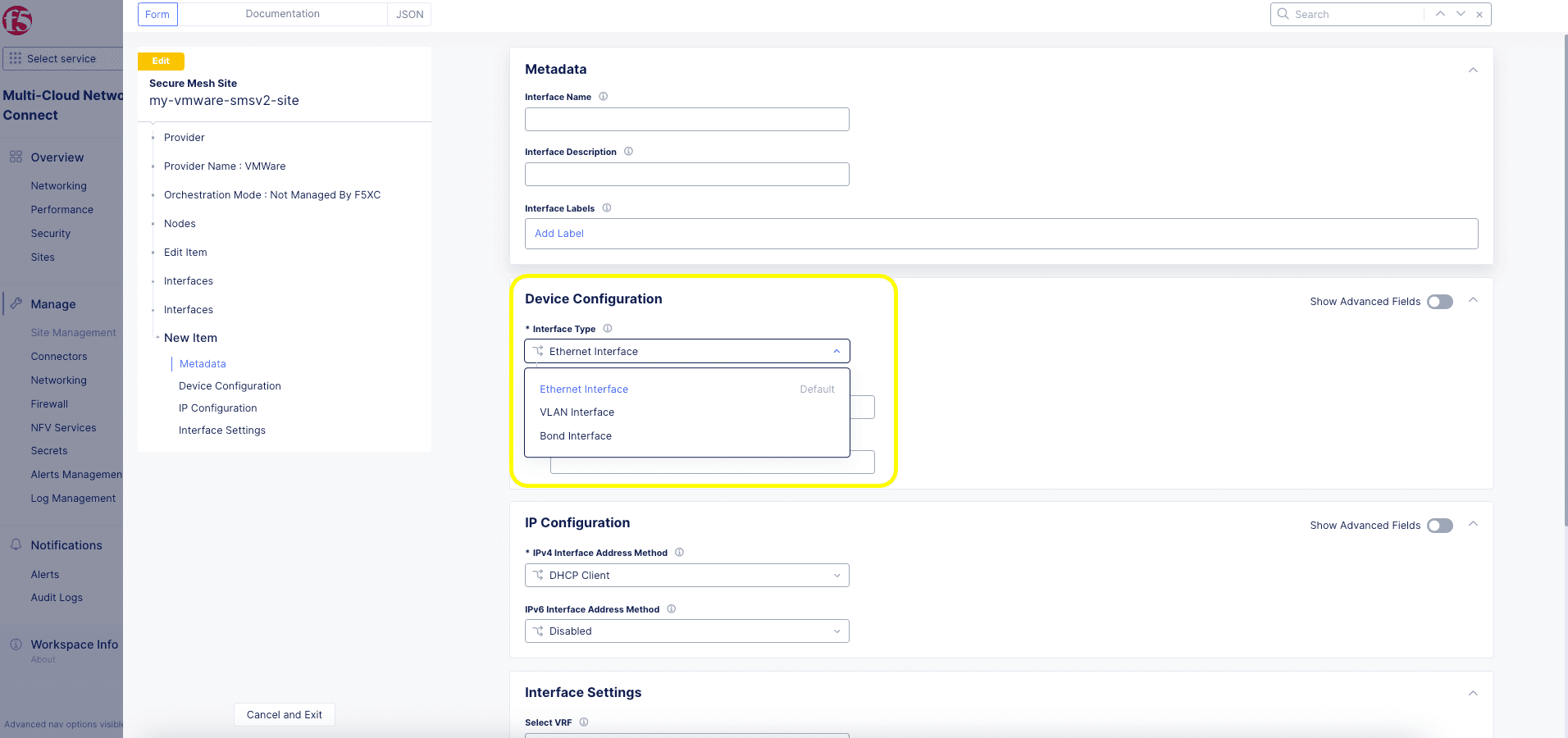 Figure: Interface Type